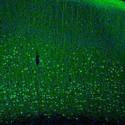 Invitrogen PCP4 Polyclonal Antibody 100 &mu;L; Unconjugated:Antibodies,