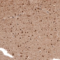 Invitrogen PCP4 Polyclonal Antibody 100 &mu;L; Unconjugated:Antibodies,