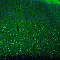 Invitrogen PCP4 Polyclonal Antibody 100 &mu;L; Unconjugated:Antibodies,