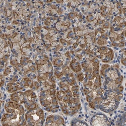 Invitrogen C6orf211 Polyclonal Antibody 100 &mu;L; Unconjugated:Antibodies,