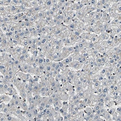 Invitrogen eIF2b beta Polyclonal Antibody 100 &mu;L; Unconjugated:Antibodies,