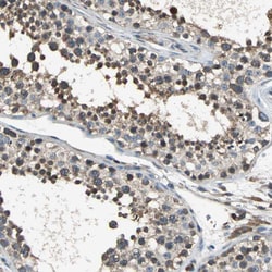 Invitrogen eIF2b beta Polyclonal Antibody 100 &mu;L; Unconjugated:Antibodies,