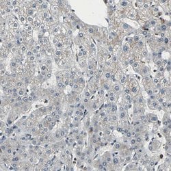 Invitrogen eIF2b beta Polyclonal Antibody 100 &mu;L; Unconjugated:Antibodies,