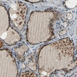 Invitrogen eIF2b beta Polyclonal Antibody 100 &mu;L; Unconjugated:Antibodies,