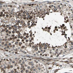 Invitrogen EXD2 Polyclonal Antibody 100 &mu;L; Unconjugated:Antibodies,