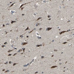 Invitrogen TRAK1 Polyclonal Antibody 100 &mu;L; Unconjugated:Antibodies,
