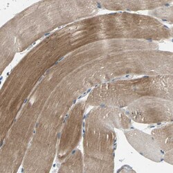 Invitrogen TRAK1 Polyclonal Antibody 100 &mu;L; Unconjugated:Antibodies,