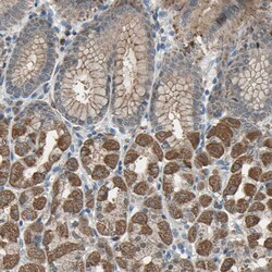 Invitrogen TRAK1 Polyclonal Antibody 100 &mu;L; Unconjugated:Antibodies,