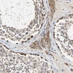 Invitrogen TRAK1 Polyclonal Antibody 100 &mu;L; Unconjugated:Antibodies,