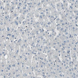Invitrogen POLR3K Polyclonal Antibody 100 &mu;L; Unconjugated:Antibodies,