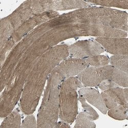 Invitrogen UCH37 Polyclonal Antibody 100 &mu;L; Unconjugated:Antibodies,