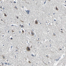 Invitrogen MCT2 Polyclonal Antibody 100 &mu;L; Unconjugated:Antibodies,