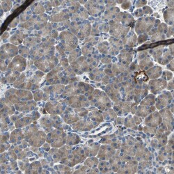 Invitrogen MCT2 Polyclonal Antibody 100 &mu;L; Unconjugated:Antibodies,