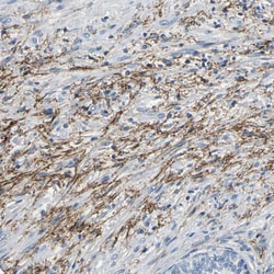 Invitrogen MCT2 Polyclonal Antibody 100 &mu;L; Unconjugated:Antibodies,