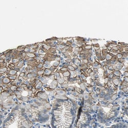 Invitrogen MCT2 Polyclonal Antibody 100 &mu;L; Unconjugated:Antibodies,