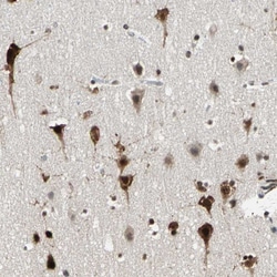 Invitrogen HLX Polyclonal Antibody 100 &mu;L | Buy Online | Invitrogen&trade; | Fisher Scientific