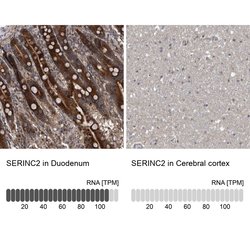 Invitrogen SERC2 Polyclonal Antibody 100 &mu;L; Unconjugated:Antibodies,
