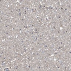 Invitrogen SERC2 Polyclonal Antibody 100 &mu;L; Unconjugated:Antibodies,