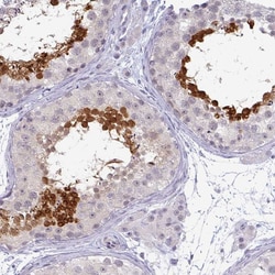 Invitrogen TEX33 Polyclonal Antibody 100 &mu;L; Unconjugated:Antibodies,