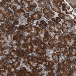 Invitrogen RPL35 Polyclonal Antibody 100 &mu;L; Unconjugated:Antibodies,