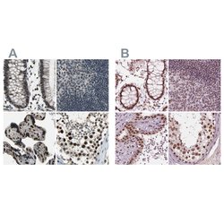 Invitrogen ELF2 Polyclonal Antibody 100 &mu;L; Unconjugated:Antibodies,