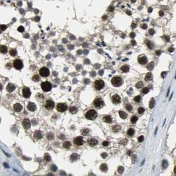 Invitrogen ELF2 Polyclonal Antibody 100 &mu;L; Unconjugated:Antibodies,