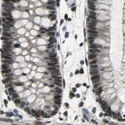 Invitrogen ELF2 Polyclonal Antibody 100 &mu;L; Unconjugated:Antibodies,