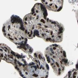 Invitrogen ELF2 Polyclonal Antibody 100 &mu;L; Unconjugated:Antibodies,