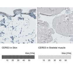 Invitrogen Lass3 Polyclonal Antibody 100 &mu;L; Unconjugated:Antibodies,