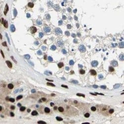 Invitrogen NFIA Polyclonal Antibody 100 &mu;L; Unconjugated:Anticuerpos