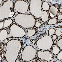 Invitrogen NFIA Polyclonal Antibody 100 &mu;L; Unconjugated:Anticuerpos