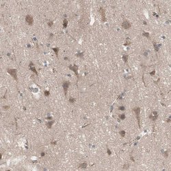 Invitrogen HMBS Polyclonal Antibody 100 &mu;L; Unconjugated:Antikroppar