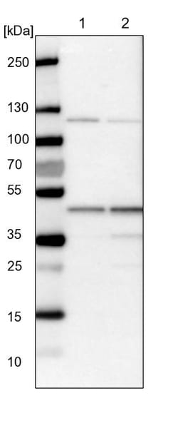 Invitrogen HMBS Polyclonal Antibody 100 &mu;L; Unconjugated:Antikroppar