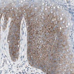 Invitrogen RPS12 Polyclonal Antibody 100 &mu;L; Unconjugated:Antibodies,