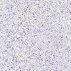 Invitrogen CXorf67 Polyclonal Antibody 100 &mu;L | Buy Online | Invitrogen&trade; | Fisher Scientific