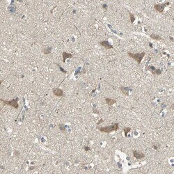 Invitrogen SCK Polyclonal Antibody 100 &mu;L | Buy Online | Invitrogen&trade; | Fisher Scientific