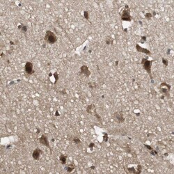 Invitrogen ZNF18 Polyclonal Antibody 100 &mu;L; Unconjugated:Antibodies,