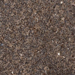 Invitrogen ZNF18 Polyclonal Antibody 100 &mu;L; Unconjugated:Antibodies,