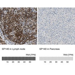 Invitrogen SP140 Polyclonal Antibody 100 &mu;L; Unconjugated:Antibodies,