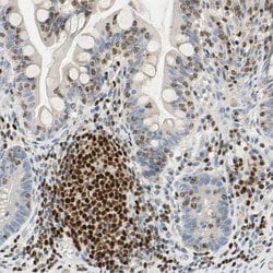 Invitrogen SP140 Polyclonal Antibody 100 &mu;L; Unconjugated:Antibodies,