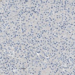 Invitrogen SP140 Polyclonal Antibody 100 &mu;L; Unconjugated:Antibodies,