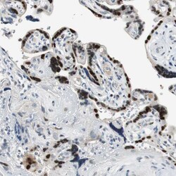 Invitrogen AJUBA Polyclonal Antibody 100 &mu;L; Unconjugated:Antibodies,