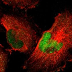 HCFC2 Polyclonal Antibody:Antibodies, Polyclonal