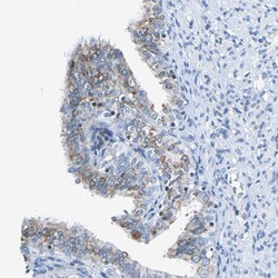 HCFC2 Polyclonal Antibody:Antibodies, Polyclonal