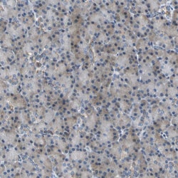 HCFC2 Polyclonal Antibody:Antibodies, Polyclonal