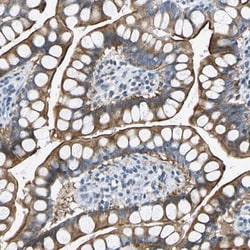 HCFC2 Polyclonal Antibody:Antibodies, Polyclonal