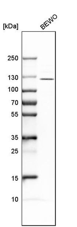 Invitrogen ADAMTSL4 Polyclonal Antibody 100 &mu;L; Unconjugated:Antibodies,