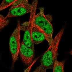 Invitrogen TNRC4 Polyclonal Antibody 100 &mu;L; Unconjugated:Antibodies,