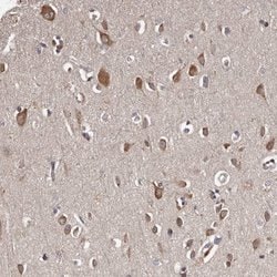 Invitrogen TNRC4 Polyclonal Antibody 100 &mu;L; Unconjugated:Antibodies,
