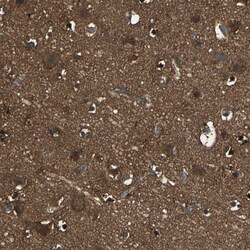 Invitrogen DDAH1 Polyclonal Antibody 100 &mu;L; Unconjugated:Antibodies,